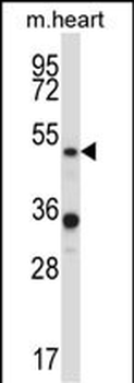 PIAS4 Antibody (N-term)