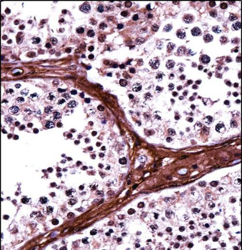 BRD1 Antibody (N-term)