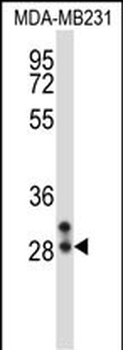 NEUROG2 Antibody (Center)