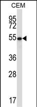GABPA Antibody (Center)