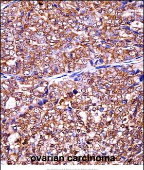 EIF5A2 Antibody (C-term)