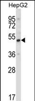 UBP1 Antibody (Center)