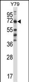 FARSB Antibody (C-term)