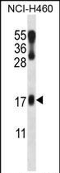 LMO2 Antibody (N-term)