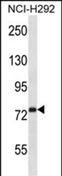 RPH3A Antibody (C-term)