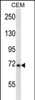 KCND3 Antibody (N-term)
