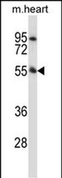 Mouse Pink1 Antibody (N-term)