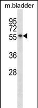 Mouse Sgk3 Antibody (C-term)