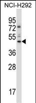 TEAD3 Antibody (N-term)