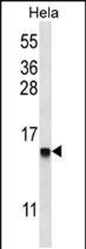 DEFB112 Antibody (N-term)