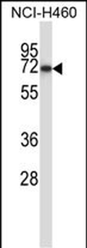 FZD9 Antibody (N-term)
