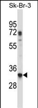 RPL8 Antibody (C-term)