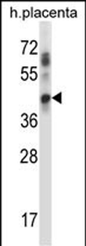 UBE2J1 Antibody (N-term)