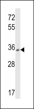 P2RY10 Antibody (Center)