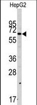 SWAP70 Antibody (Center)
