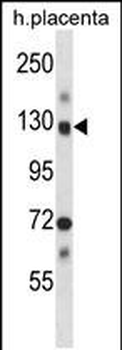 Mouse Nek9 Antibody (Center)