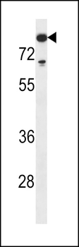 TDT Antibody (N-term)