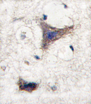 SPRED1 Antibody (C-term)