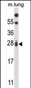 RIT1 Antibody (N-term)