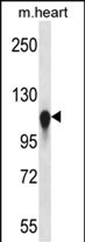 KIF5C Antibody (C-term)