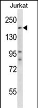 SUPT5H Antibody (Center)