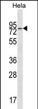 WASF2 Antibody (Center)
