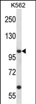 KCNC3 Antibody (C-term)