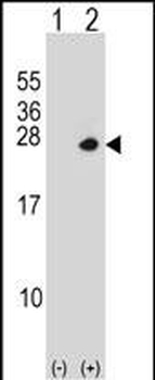 PSMD10 Antibody (C-term)