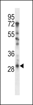 TAF9 Antibody (N-term)