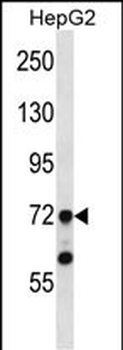 TAF6 Antibody (N-term)