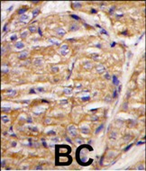 MIPEP Antibody (N-term)