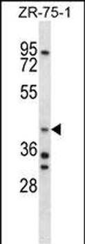AIP Antibody (C-term)
