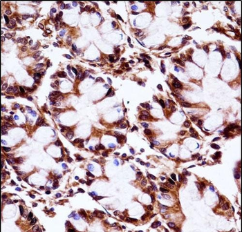 AIP Antibody (C-term)