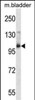 Mouse Aak1 Antibody (Center)