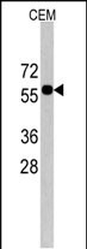 CNOT4 Antibody (C-term)