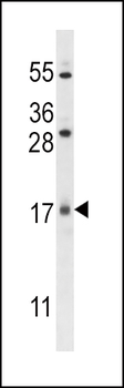 SZRD1 Antibody (N-term)
