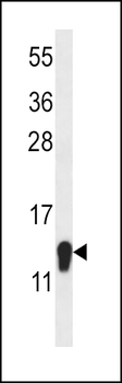 SZRD1 Antibody (N-term)