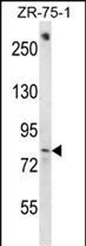 BACH1 Antibody (C-term)