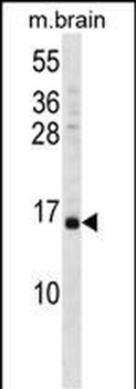 VAMP3 Antibody (Center)