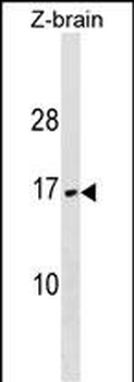 VAMP3 Antibody (Center)