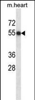 Mouse Csnk1d Antibody (Center)