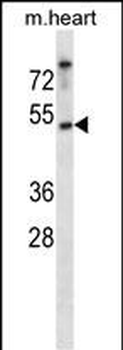 Mouse Csnk1e Antibody (C-term)
