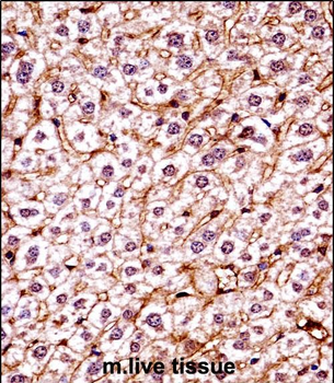 Mouse Csnk1e Antibody (C-term)