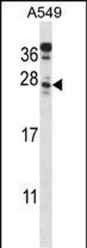 MGARP Antibody (C-term)