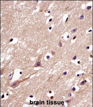 MGARP Antibody (C-term)
