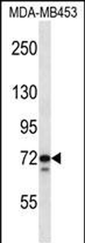 TMPO Antibody (N-term)