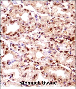 TMPO Antibody (N-term)