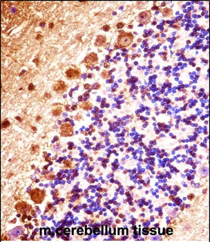 Mouse Stk32b Antibody (C-term)