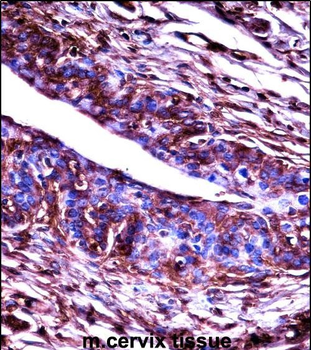 Mouse Adrbk2 Antibody (C-term)