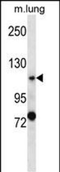 PKD2 Antibody (C-term)